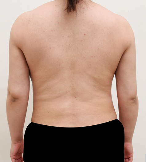 Before Image
