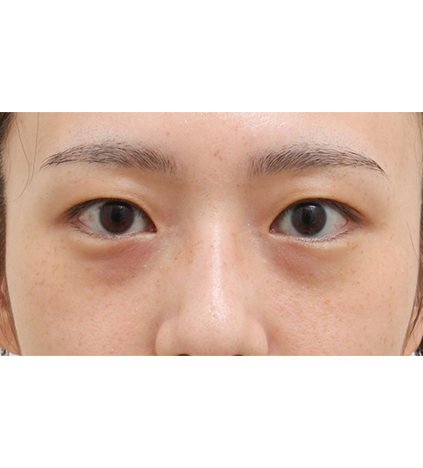Before Image