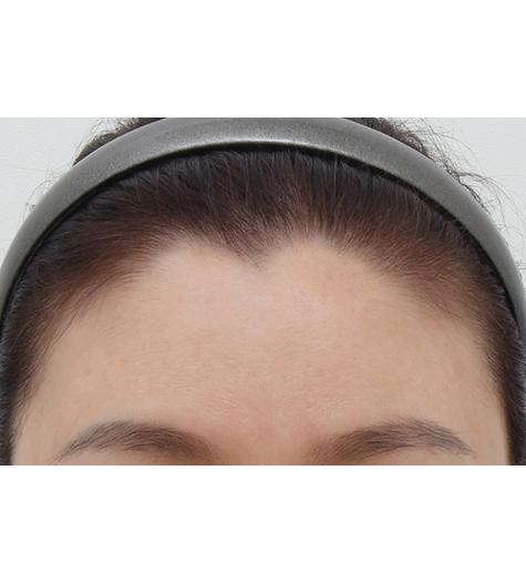 Before Image