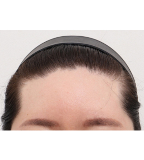 Before Image