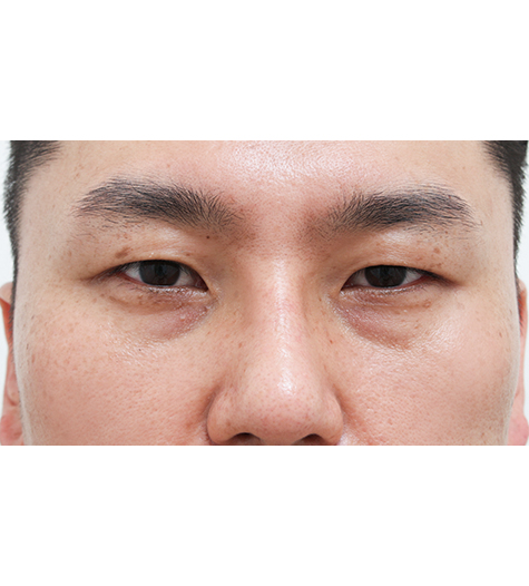 Before Image