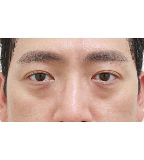 Before Image