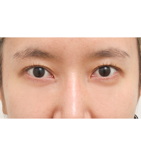Before Image