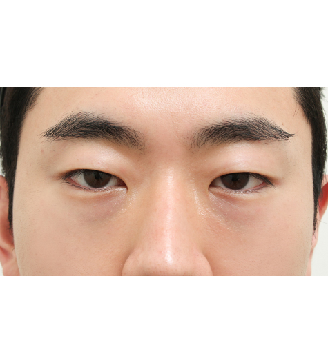 Before Image