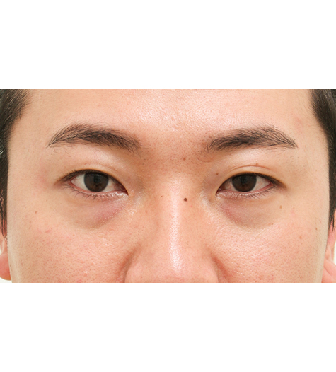 Before Image